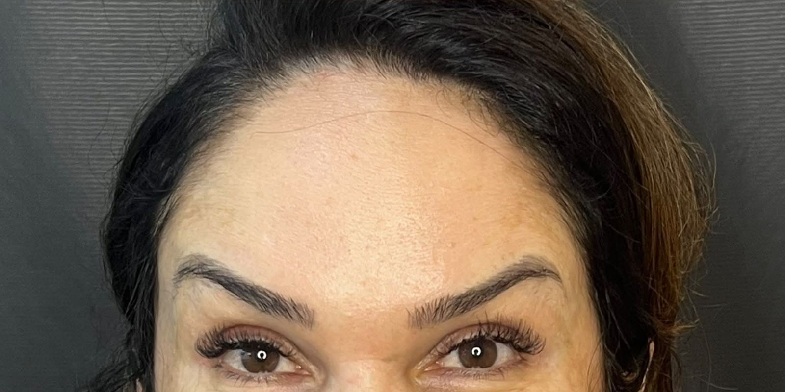 Depois — Rejuvenescimento do olhar